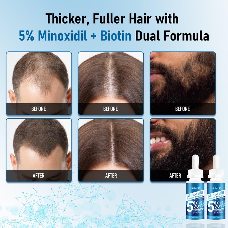 Pickclub 5% Minoxidil with Biotin for Men and Women – Hair and Beard Regrowth Serum, Unisex, Gentle, 2-Pack (Total 4.06 fl oz)