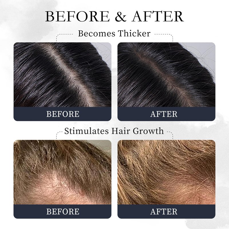 Novastile Rosemary Hair Oil – Dry Scalp & Split End Treatment with Biotin & Essential Oils for Strengthening, Nourishing, Moisturizing & Supporting Longer, Healthier Hair