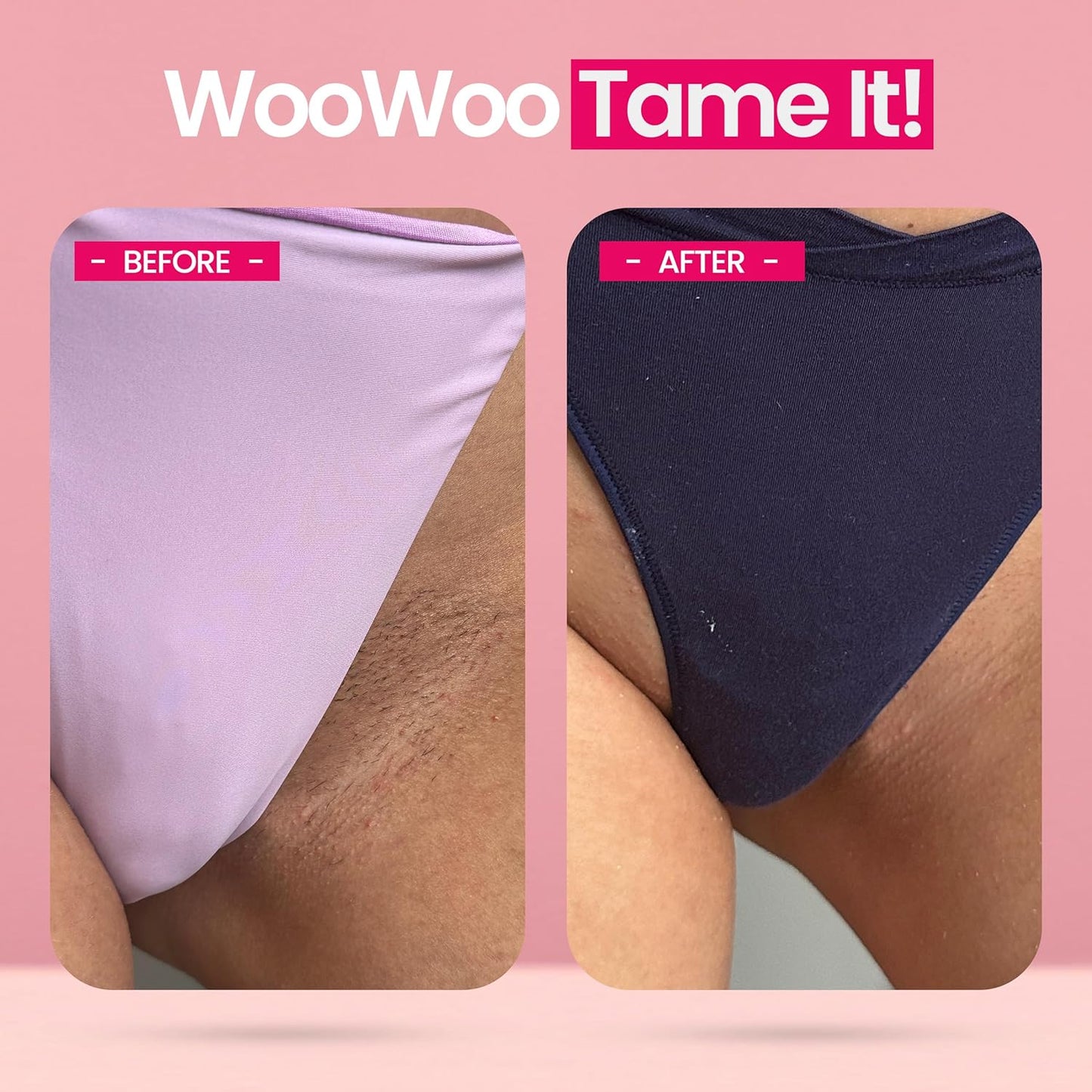 WooWoo Tame It! Natural Intimate Hair Removal Cream - Painless Vegan Hair Remover For Sensitive Skin - Depilatory For Genitals, Bikini, Legs & Bum - Women In-Shower Cream With Aloe Vera - 200ml