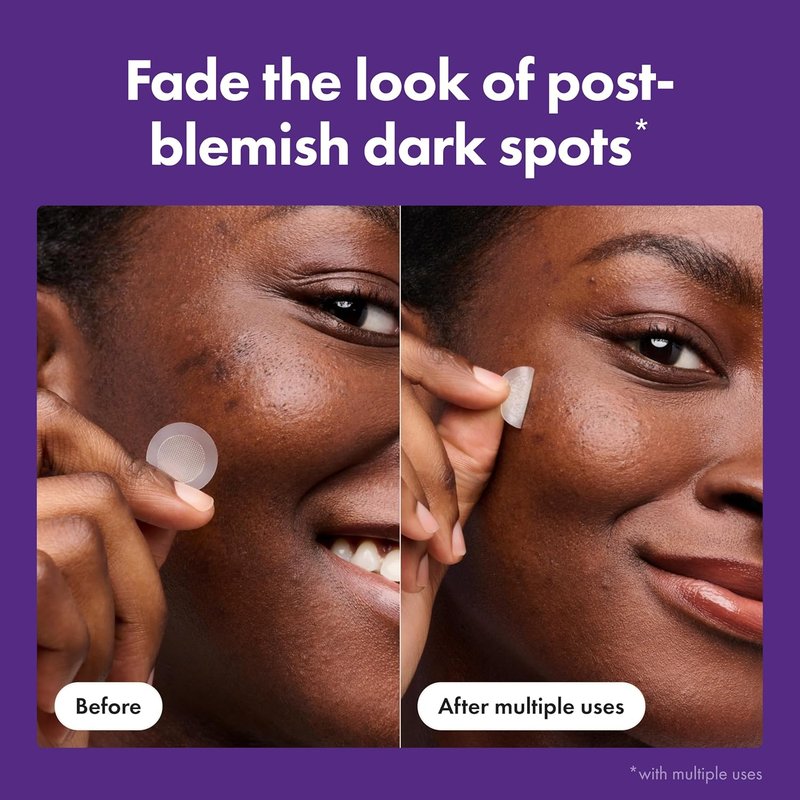 Mighty Patch Dark Spot Remover - Micropoint™ Blemish Patches with 395 Micropoints | 8 Count, Dermatologist Tested