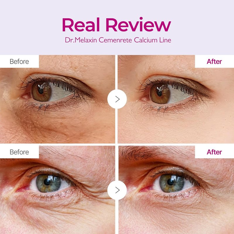Dr. Melaxin Calcium Volume Eye Patch - Revitalize Sagging Under Eyes & Reduce Dark Circles | 60 Patches