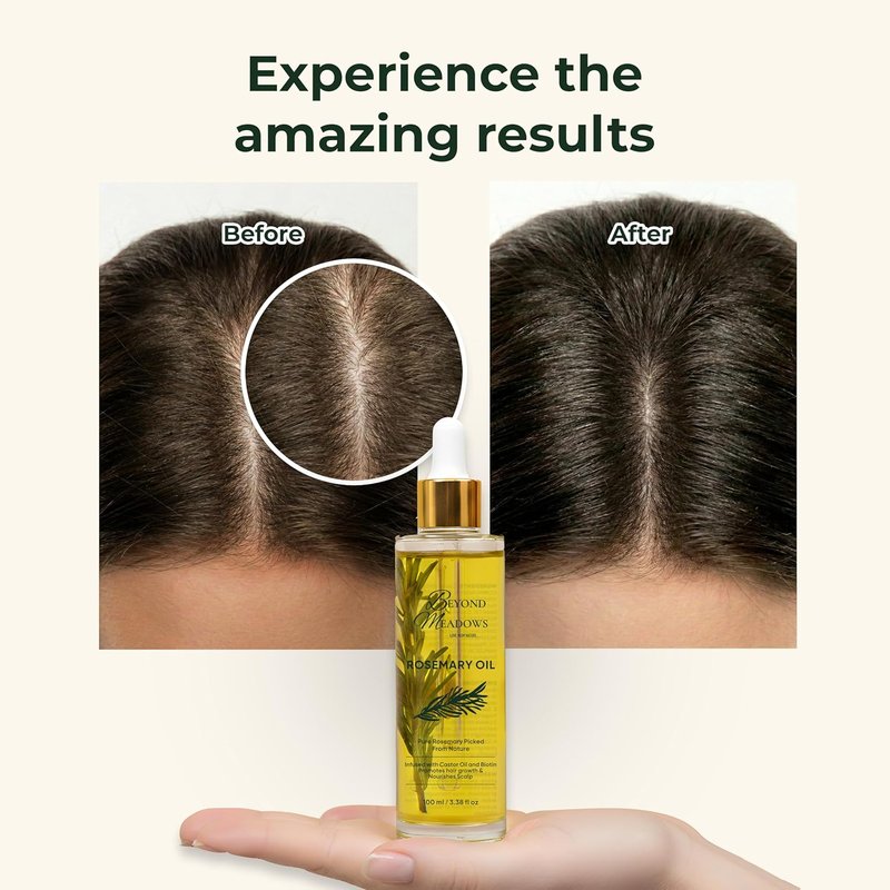 Organic Rosemary Oil for Hair Growth - Infused with Biotin, Castor Oil & Peppermint for Stronger Roots | 3.38 fl oz