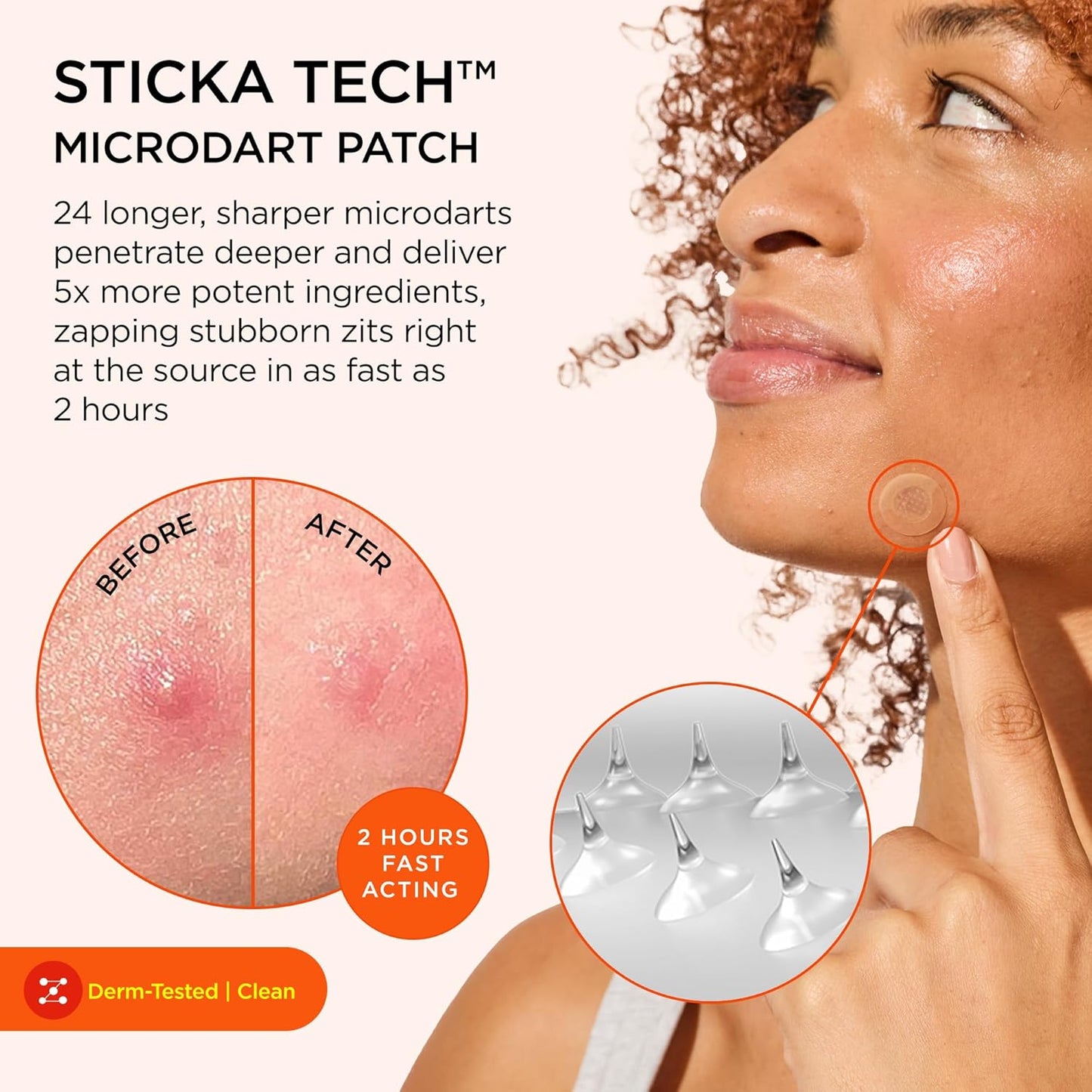 ZitSticka Extra Strength Killa Acne Microdart Patches - Fast-Acting OTC Treatment with 2% Salicylic Acid | 4 Count