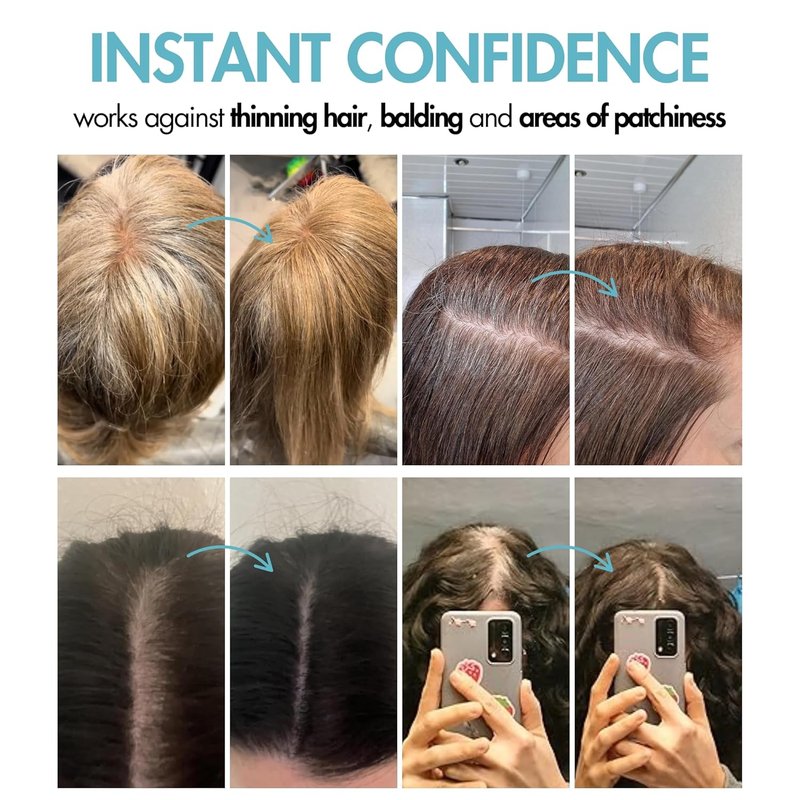 Hair Genetics Root Touch Up Powder - Natural Grey Hair Coverage with Mineral Technology | Dark Brown