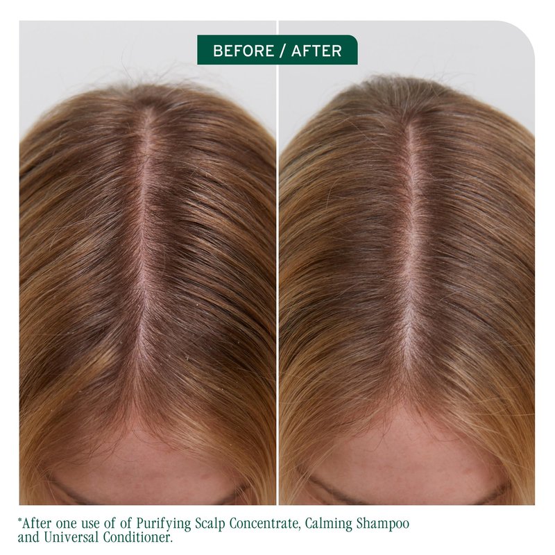 Biolage Scalp Sync Universal Conditioner - Nourishing & Hydrating for All Scalp Types, Lightweight Moisturizing & Conditioning, Fermented Tea Blend & Glycolic Acid, Vegan & Paraben-Free, 7.9 Fl Oz