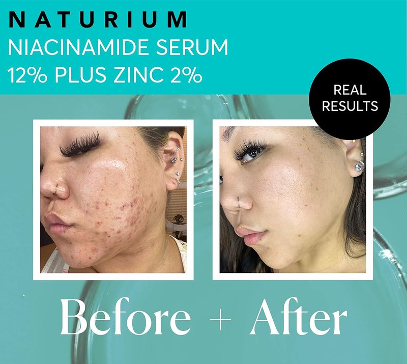 Naturium Niacinamide Face Serum 12% | Anti-Aging, Pore Minimizer & Dark Spot Corrector with Zinc, 1 oz