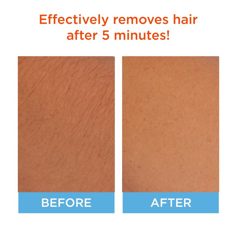 Sally Hansen Hair Remover for Face | Cream Depilatory + Aftercare Lotion | Sweet Almond & Shea Butter Infused