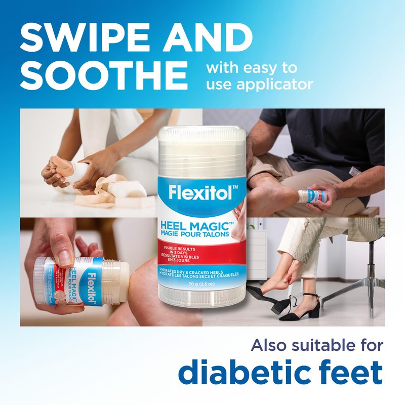 Flexitol Heel Magic Stick, Cracked Heel Cream & Foot Balm, Urea-Based Moisturizing Stick with Shea Butter & Vitamin E, 2.5 oz