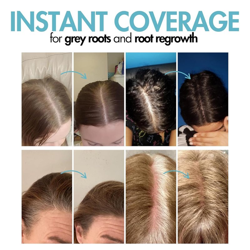 Hair Genetics Root Touch Up Powder - Natural Grey Hair Coverage with Mineral Technology | Dark Brown