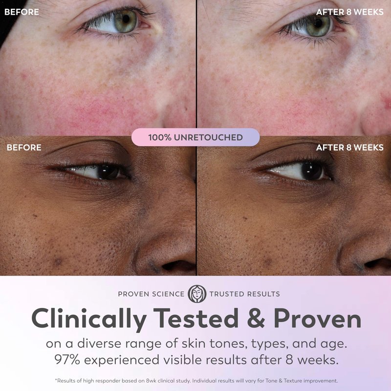 Olay Super Serum - Glow Serum for Face - Activated Niacinamide, Vitamin C & E, Collagen Peptide, AHA - 5-in-1 Benefits - Brightens, Hydrates, Smooths, Firms, Evens Tone, Proactive Anti-Aging, 1.0 Oz