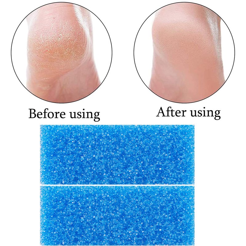 40 Pcs Pumice Stone for Feet Foot Scrubber Sponge for Feet Care and Callus Remover Mini Disposable Pumice Pads for Dead Skin Remover (Blue)