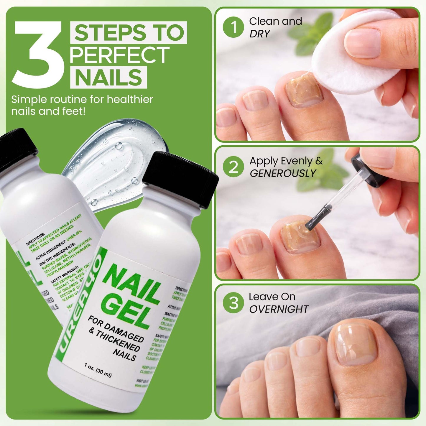 Urea Nail Gel - Softens Cracked Heel Calluses & Thick Toenails - Repairs Damaged, Yellow, Discolored Nails – Highly Effective & Quick-Dry Fingernails & Toenail Treatment (Urea 40%)