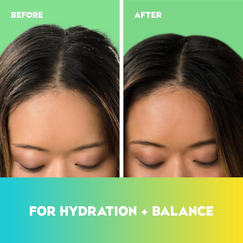 OGX Hydrating Tea Tree Mint Conditioner - Nourishing Scalp Care with Tea Tree & Peppermint Oil | 13 fl oz