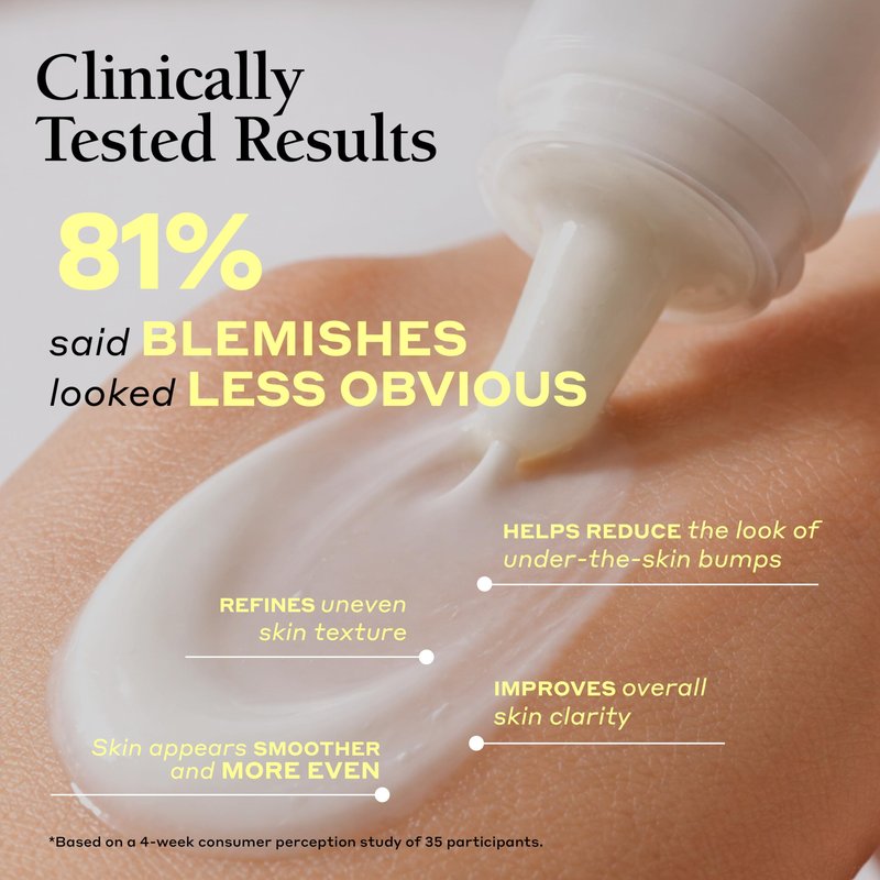 Mario Badescu Deep Blemish Solution, Spot Treatment for Face with Potent Zinc Oxide, Niacinamide and B Vitamins Overnight Treatment Serum that Targets Large Blemishes Under the Skin 1 Fl Oz.