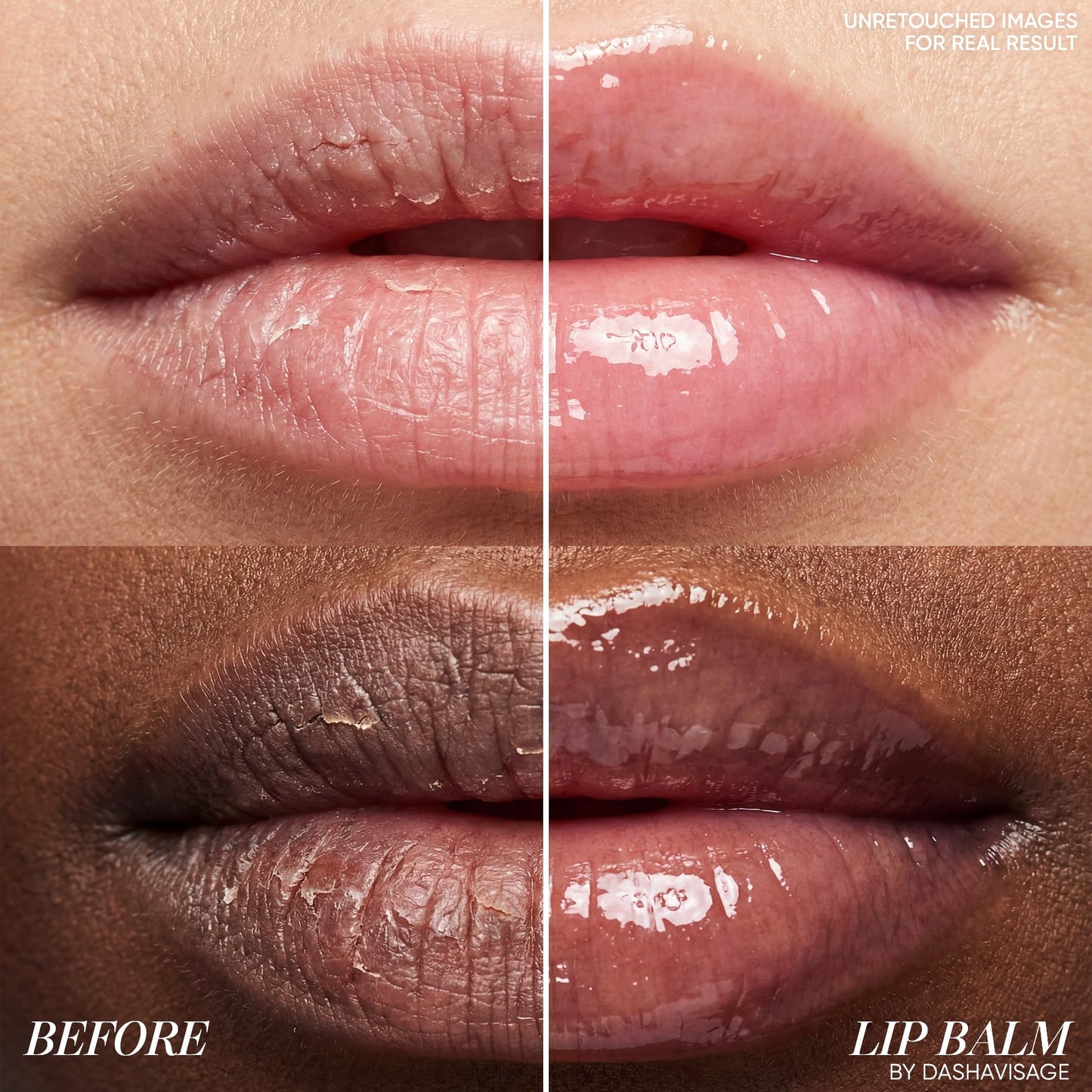 SINART Lip Perfector Balm. Hydrating Gloss Lip Balm for Dry Lips. Non-Sticky Lip Care & Repair with Coconut Oil & Jojoba Oil. Day & Night Use 0.14 oz
