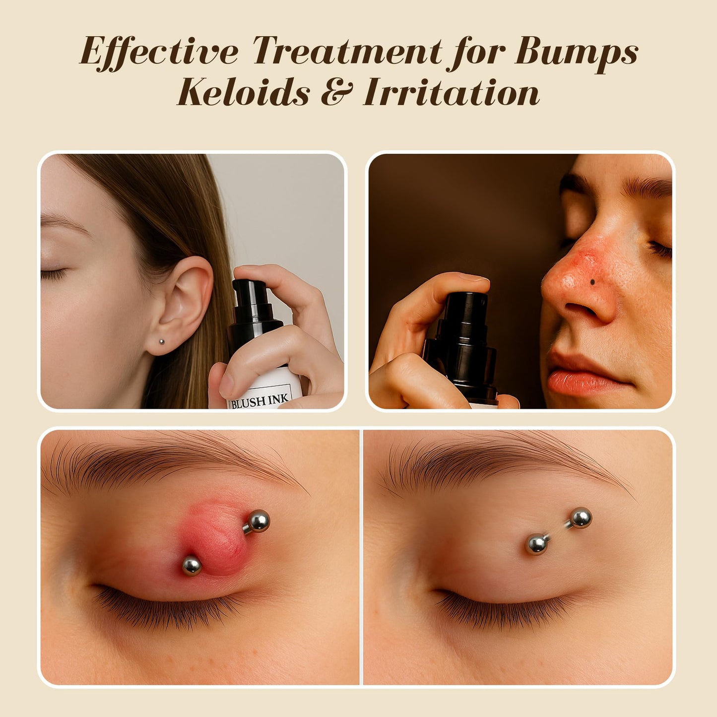 Blush Ink - Piercing Aftercare Spray | Keloid Bump Removal for Piercings | Fast-Healing Bump Piercing Treatment for Ear, Nose & Body | Gentle Hypochlorous Acid Formula for Soothing Care & Protection