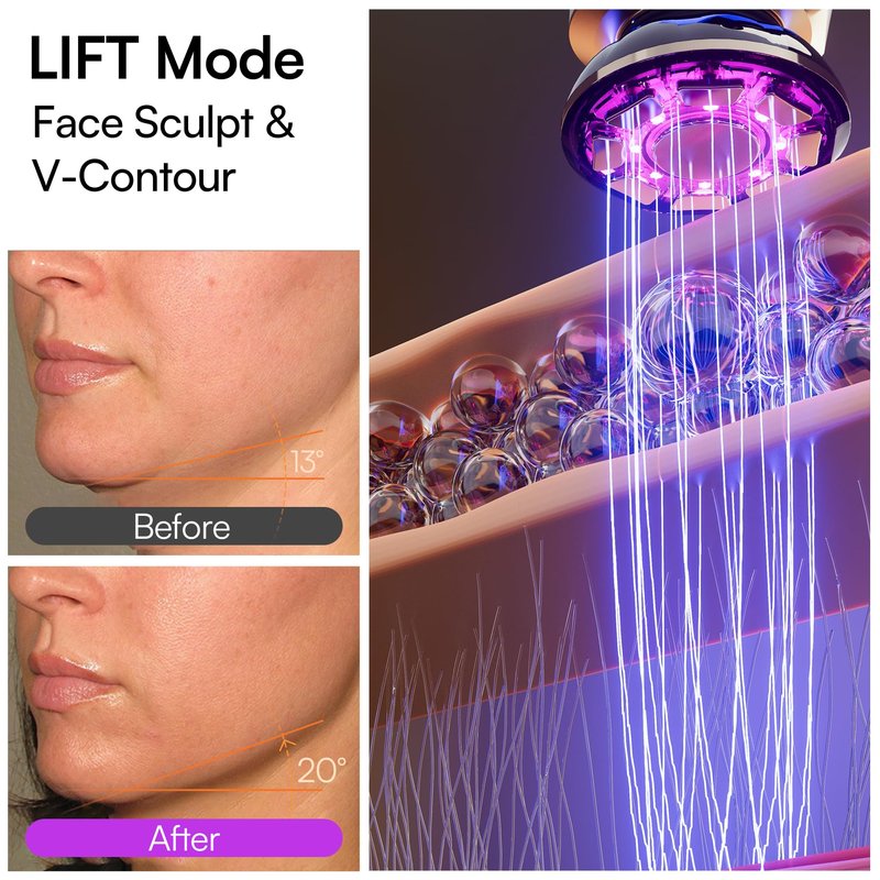 INIA 3-in-1 Red Light Therapy for Face and Neck Beauty Device for Puffiness & Skin Firming Skincare Tool