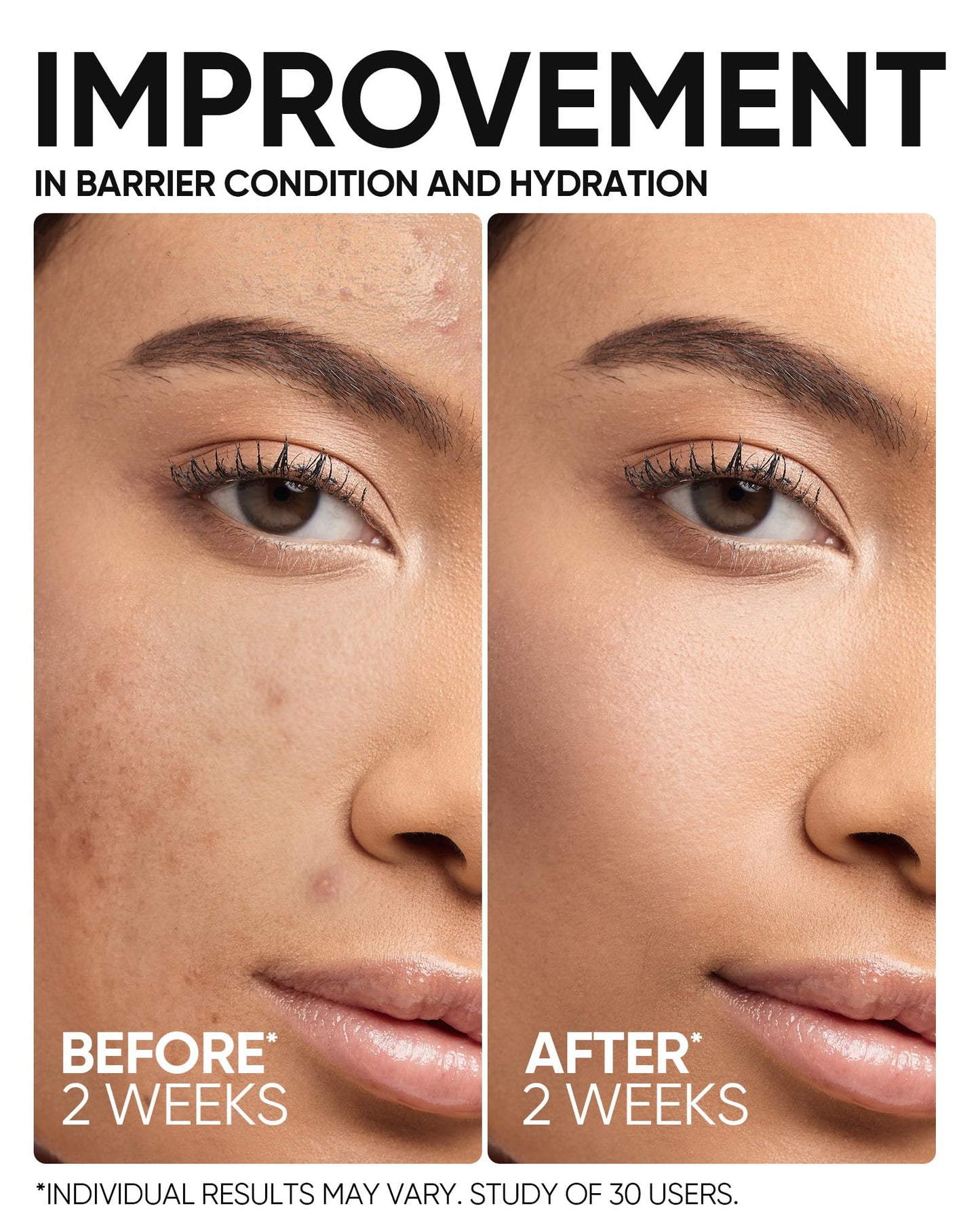 SKINTIFIC 5X Ceramide Barrier Repair Serum for Dry & Sensitive Skin Barrier Repair with Ceramide, Centella and Hyaluronic Acidx, Soothes Sensitive Skin, Reduces Redness & Strengthens Skin Barrier