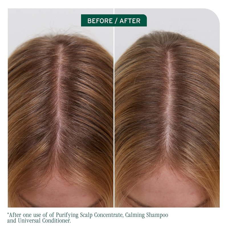 Biolage Scalp Sync Universal Conditioner - Nourishing Hydration for All Scalp Types | Vegan & Paraben-Free