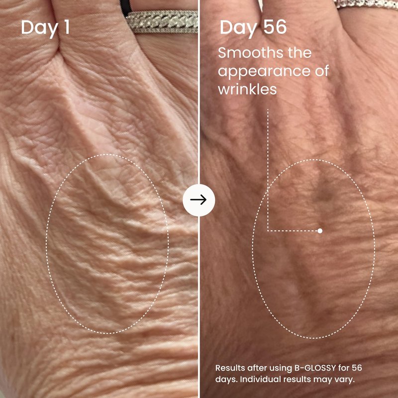 MAËLYS B-GLOSSY Hyaluronic Acid Body Serum - Firming & Hydrating Body Serum for Crepey Skin - Peptides + Meadowfoam - Helps Smooth Look of Wrinkles & Aging Skin - Lightweight Firming Serum (3.4 Fl Oz)