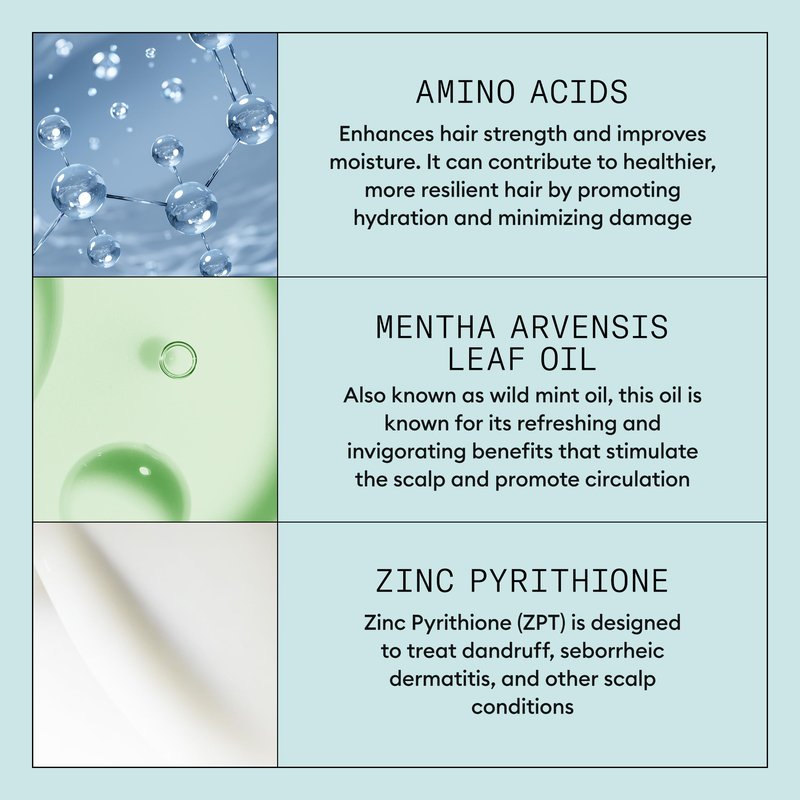 Nioxin Scalp Recovery Moisturizing Conditioner for Dry Scalp | With Pyrithione Zinc and Green Tea Extracts | 33.8 Fl oz.