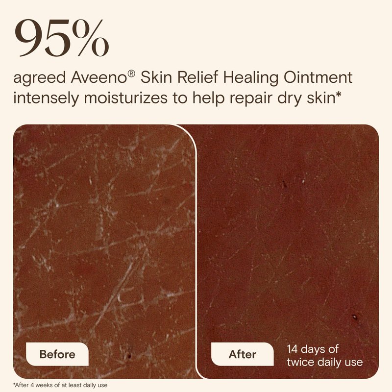 Aveeno Skin Relief Healing Ointment, for Extra Dry, Cracked & Sensitive Skin, 72-Hour Protectant with Triple Oat, Shea Butter & Glycerin, Fragrance-Free for Body, Face, Hands, Lips 7.2 oz