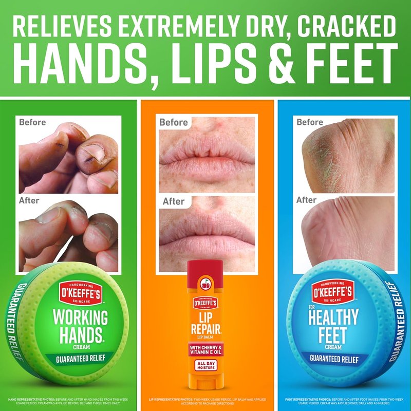 O'Keeffe's Gift Box - Lip Repair with Cherry & Vitamin E, Working Hands & Healthy Feet Jars | Perfect Gift for Moms & Caretakers