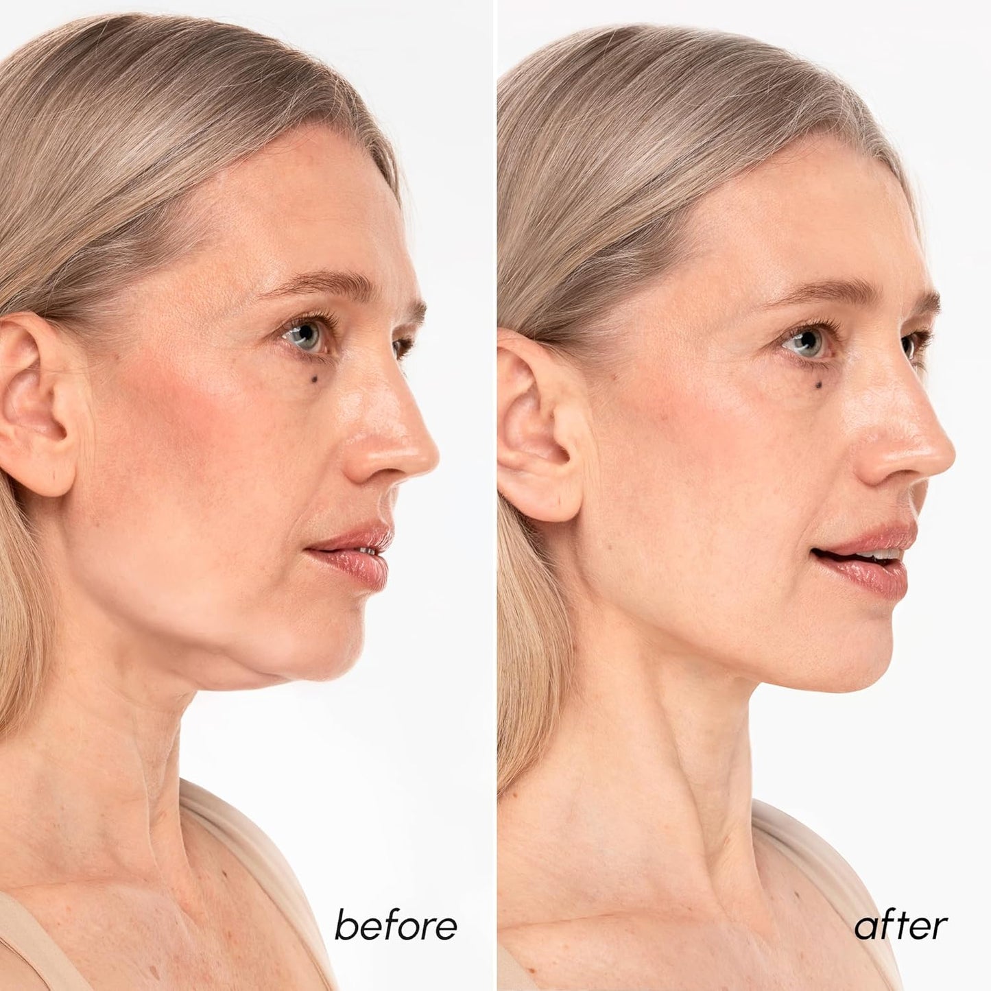 V Line Lifting Mask - 24K Gold Deep Collagen Face Mask for Women | Neck Tightening & Firming, Jawline Shaper with Retinol & Hyaluronic Acid