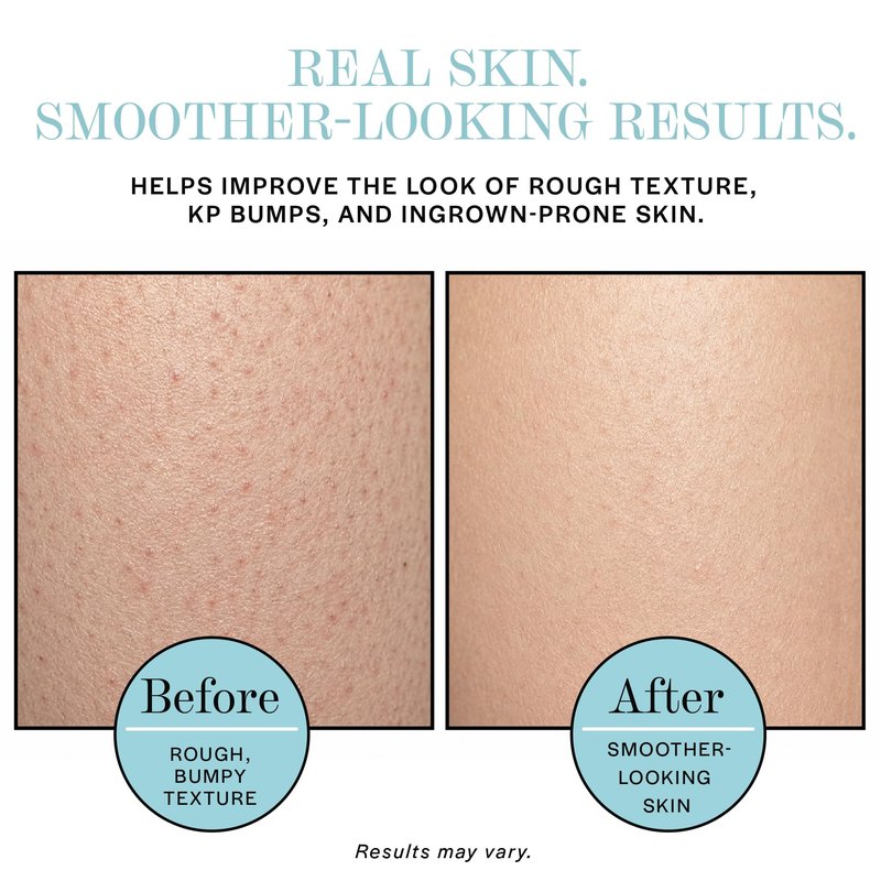 Base Laboratories Ingrown Hair - KP Bump Exfoliating Body Scrub - with AHA+BHA - Keratosis Pilaris Treatment - Daily Skin Exfoliant - Helps Reduce Strawberry Skin & Razor Bumps - Men & Women 3oz