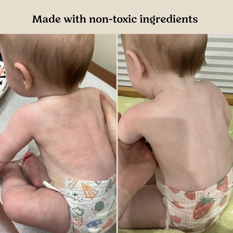 Roe Wellness Baby Cream & Serum Power Pair - Hydrating Skincare for All Ages | Body & Face Care for Toddlers & Newborns