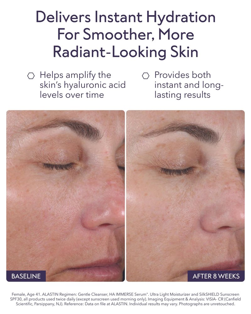 ALASTIN Skincare Hyaluronic Acid HA IMMERSE Moisturizing Face Serum (1 oz) | Restorative Serum Combats Dull, Dry, Dehydrated Skin | For Smoother, More Radiant Complexion