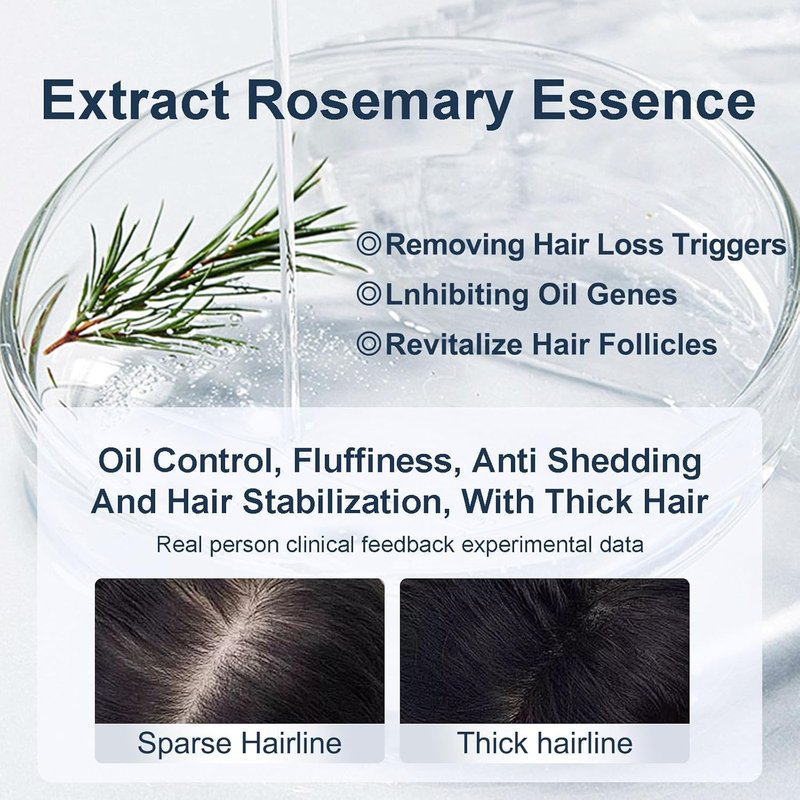 Organic Biotin & Rosemary Hair Growth Shampoo - Thickening Formula with Amino Acids for Hair Loss & Dandruff Control | Unisex