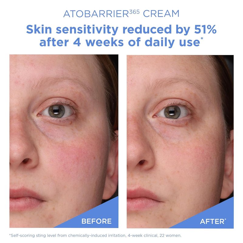 AESTURA ATOBARRIER365 Cream - Korean Face Moisturizer with Ceramides for Dry & Sensitive Skin | 120H Hydration, 80 mL