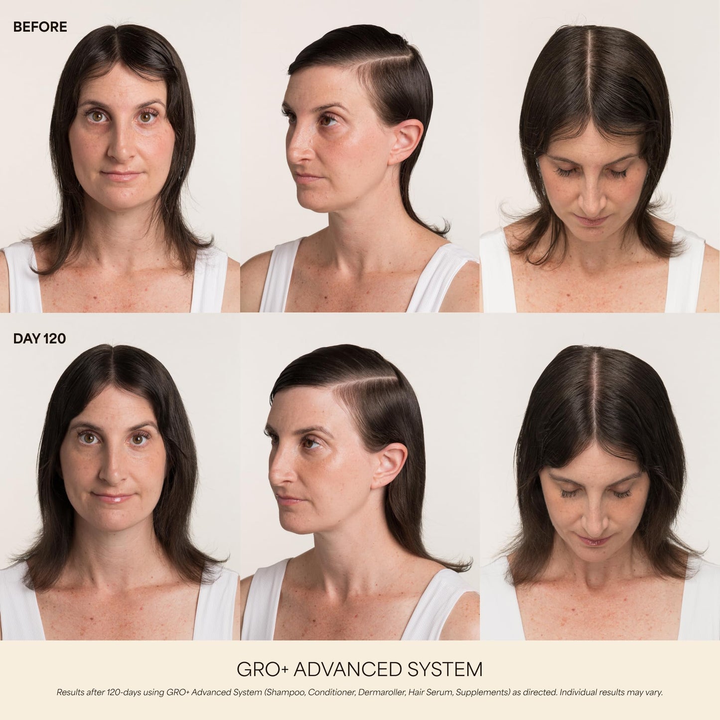 VEGAMOUR GRO+ Advanced Hair Growth Vitamin Supplements - Boosts Hair Growth & Density - 30 Pill Packs/Box