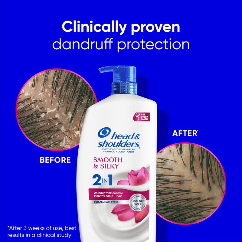Head & Shoulders Anti-Dandruff Shampoo and Conditioner with 1% Pyrithione Zinc, Smooth & Silky 2 in 1, 24-Hour Frizz Control, Soothes Dry & Itchy Scalp, Leaves Hair Healthy, Shiny & Smooth, 28.2 Fl Oz