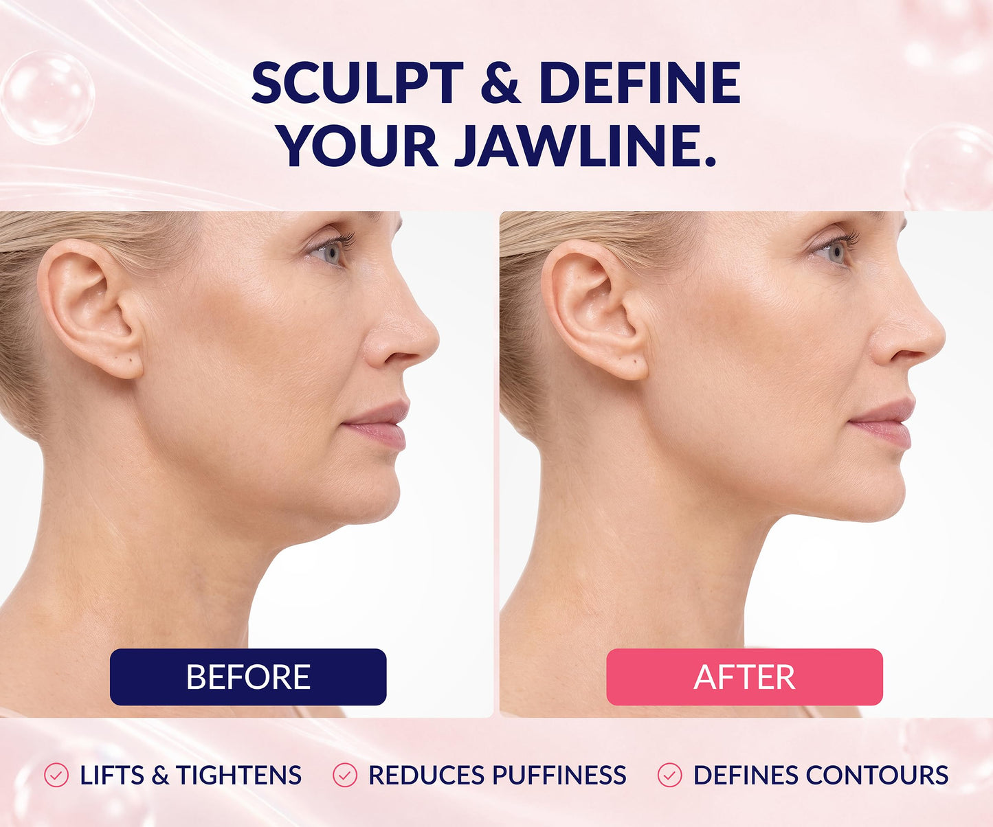 Stylia V Line Lifting Collagen Mask - Lift, Firm & Contour Jawline - Tightening Double Chin Strap with Hyaluronic Acid & Aloe - Neck Tightening and Lifting Mask - Jawline Shaper Face Lift Tape (10PC)