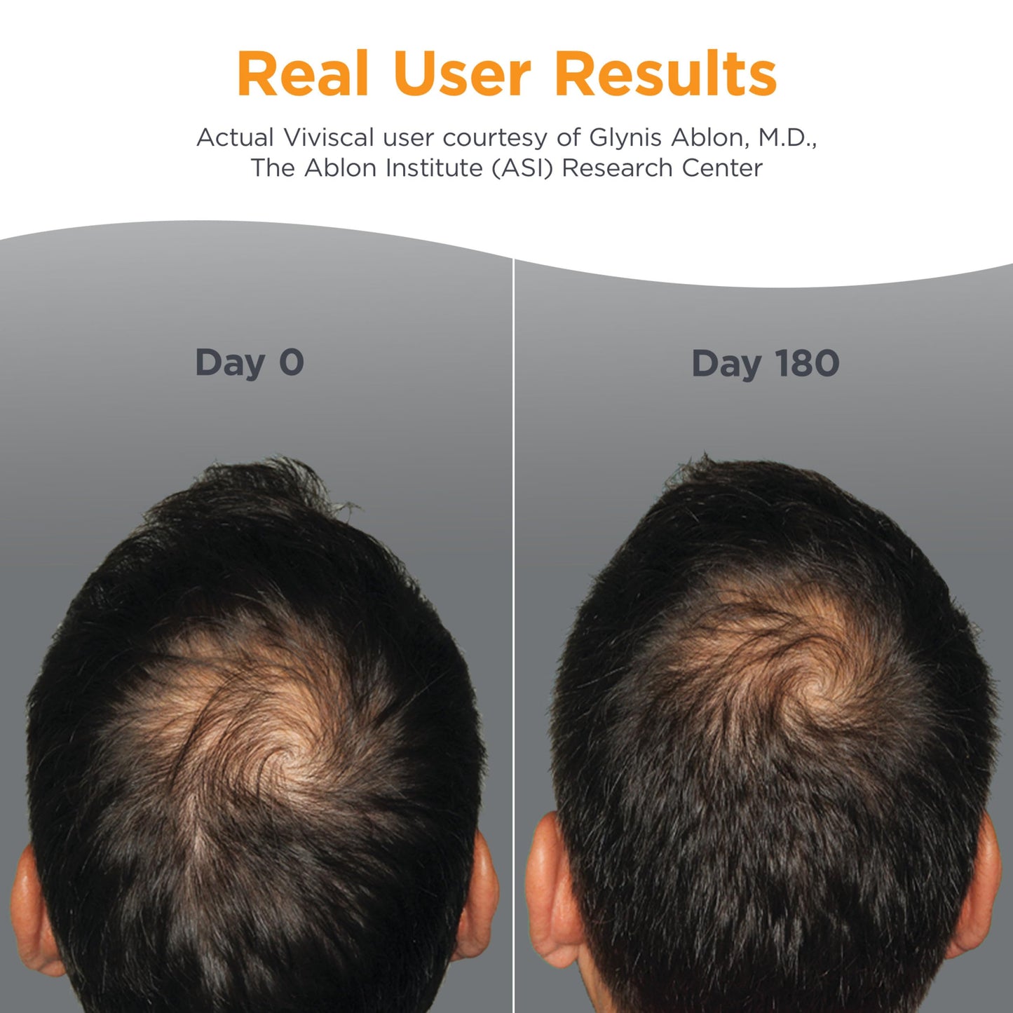 Viviscal Men's Hair Growth Supplements for Thicker Fuller Hair, Clinically Proven Collagen Complex, 180 Tablets 3 Month Supply
