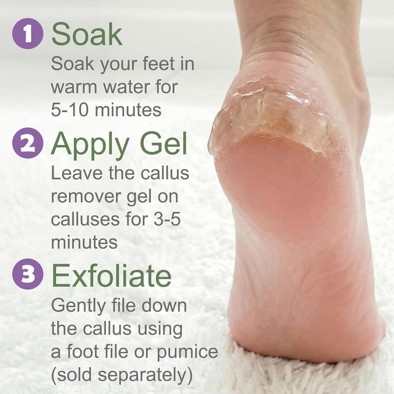 Dr. Entre's Callus Remover Gel - Extra Strength Foot Care Solution for Smooth Feet | 4 oz