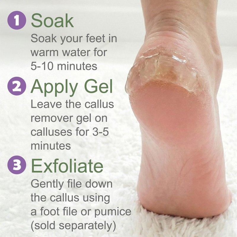 Callus Remover for Feet (Extra Strength 8 oz) Foot Callus Remover Gel, Spa Foot Care, Pedicure Tools for Feet Scrubber
