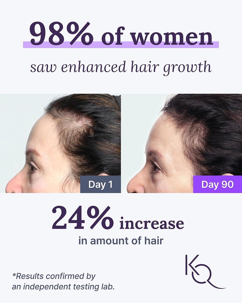 Keranique Hair & Scalp Supplements - Promote Strength and Growth with Biotin & Vital Nutrients | 30 Count