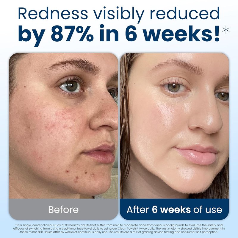Clean Skin Club Clean Towels XL® - 100% Biobased Disposable Face Towels | Ultra Soft, Eczema Approved, 200 Ct Total