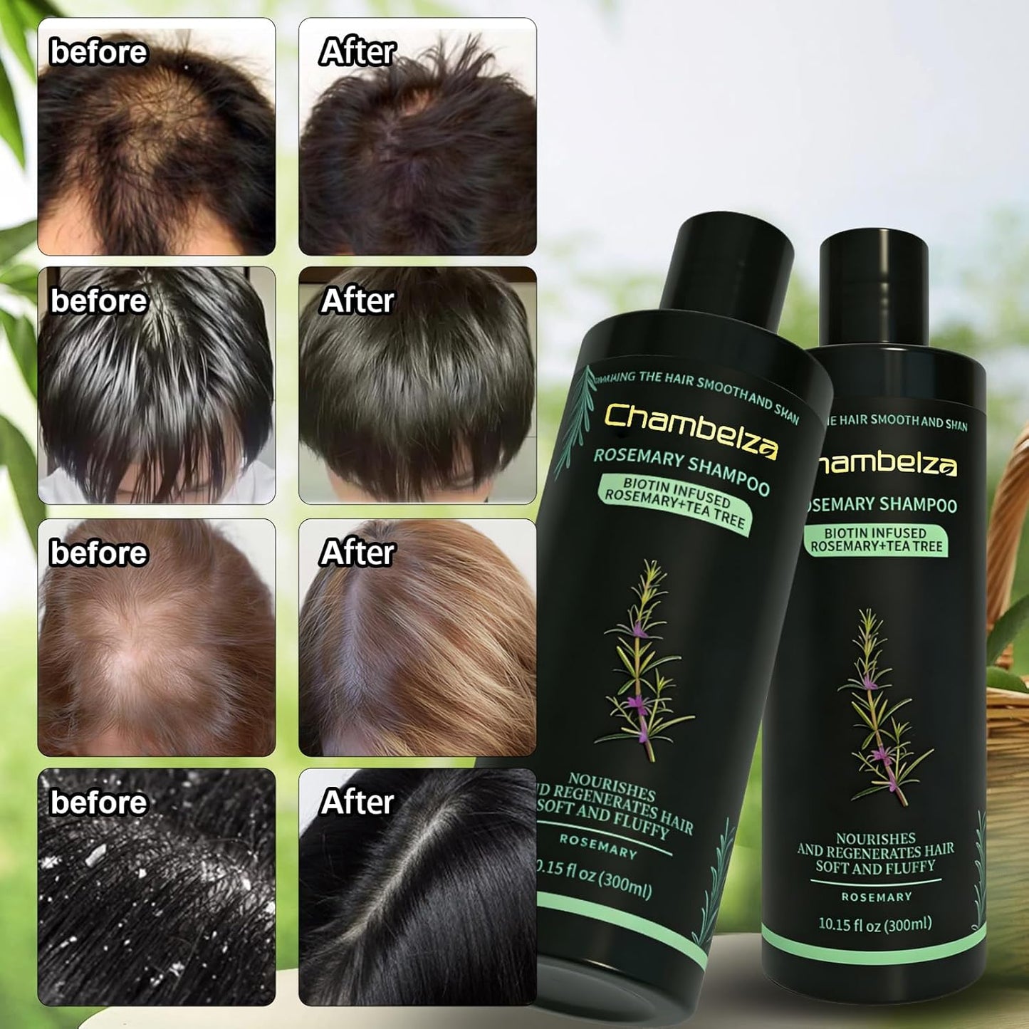 Skiennix Organic Rosemary Hair Growth Shampoo - Natural Thickening Formula with Biotin & Keratin | 10.15 fl. oz - 2 Pack