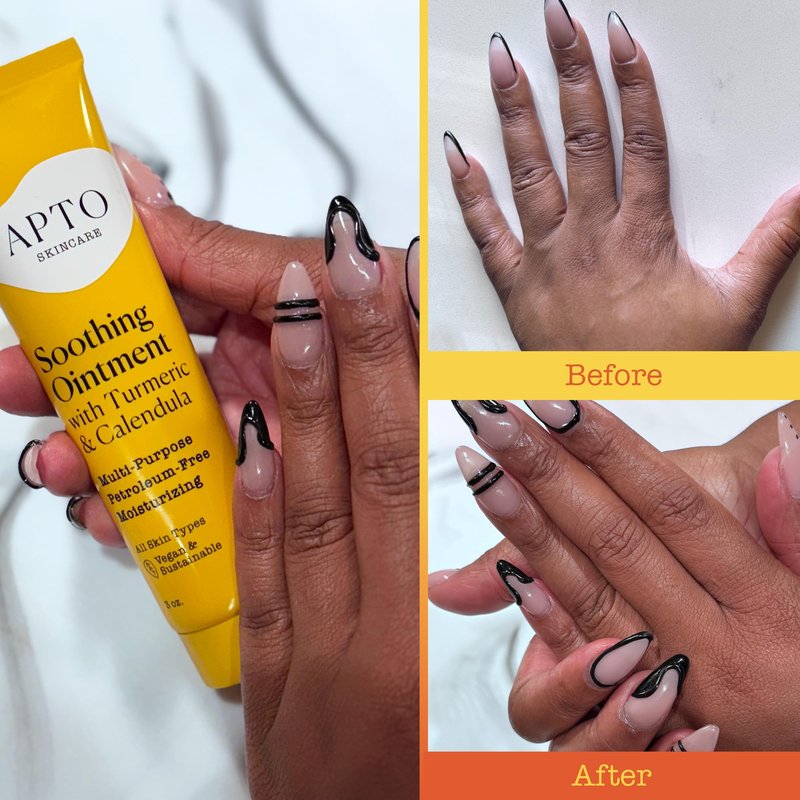 APTO Soothing Ointment w/Turmeric & Calendula: Ultra-Moisturizing Barrier Cream for Dry, Chapped Skin on Your Body, Face, or Lips, 3 oz.