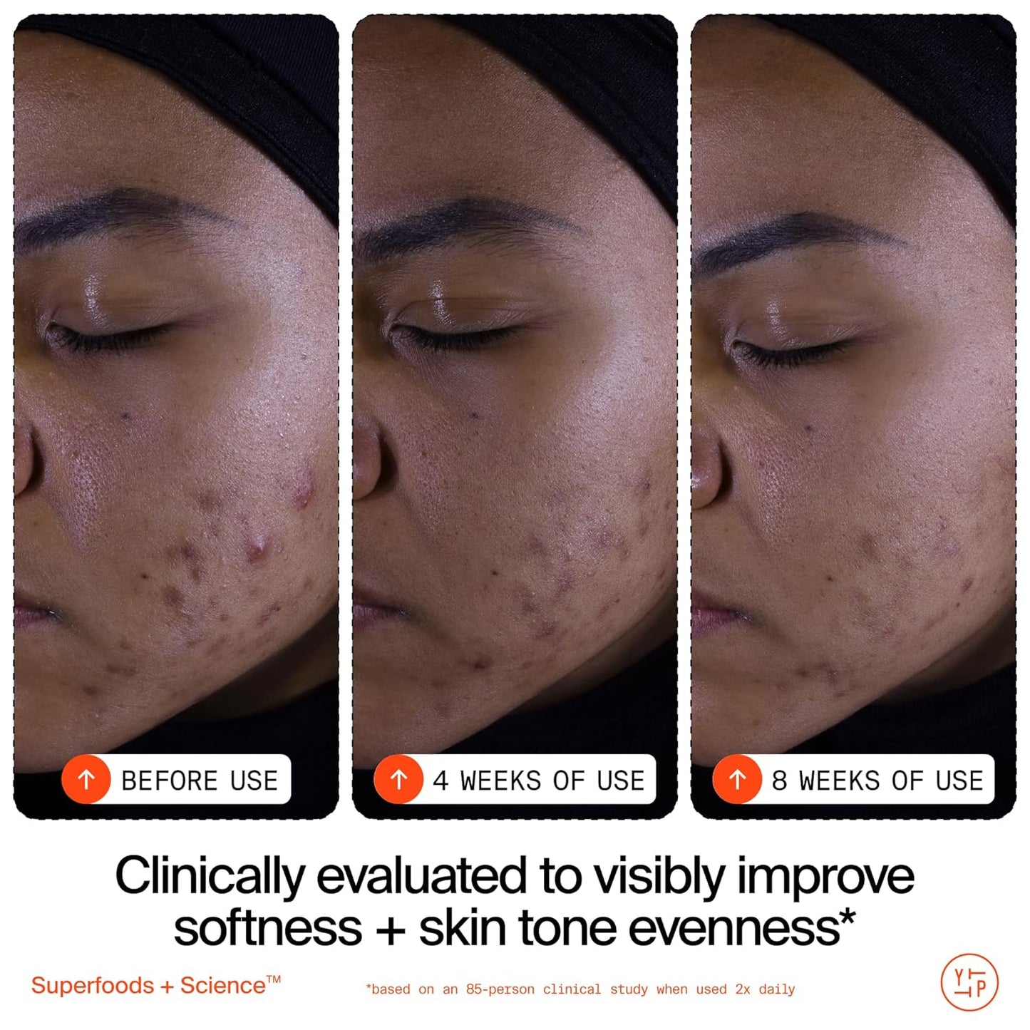 Youth To The People Superfruit Facial Cleanser - Gentle Exfoliating Face Wash with Papaya & Vitamin C for Radiant Skin, Sulfate-Free