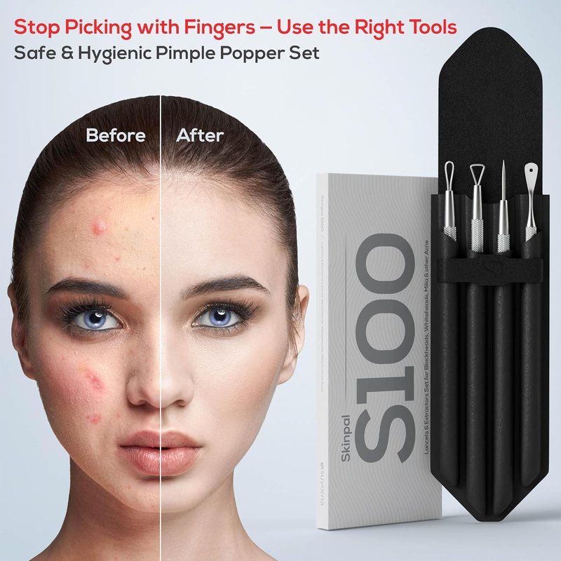 Pimple Popper Tool Kit - Milia & Blackhead Remover Set | Facial Extraction Tools for Clear Skin