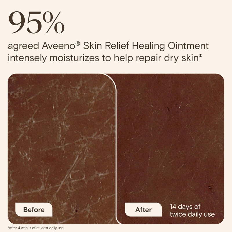 Aveeno Skin Relief Healing Ointment, Repair & Protect Extra Dry, Cracked Skin, Glycerin Protectant with Triple Oat & Shea Butter, Fragrance-Free & Non-Greasy Feel, Travel Size, 2.0 oz