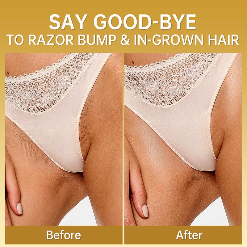 LA.PERSONAL Ingrown Hair Oil, Post-Shave Oil for Ingrown Hair & Razor Bump Prone Skin, for Bikini Line, Legs & Underarms, Pre & After Shave Oil for Women & Men, 40 ML / 1.4 FL OZ