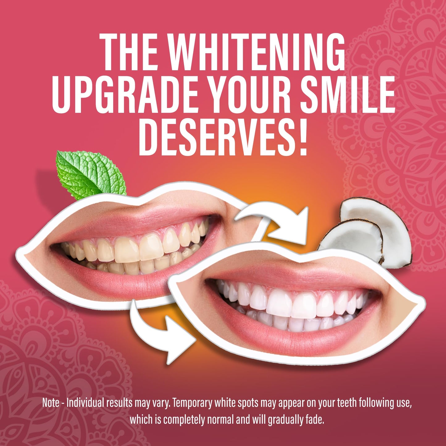 GuruNanda Sensitive Teeth Whitening Strips—9-Day Treatment, Gentle on Teeth Formula, Non-Slip, Dry Strip Technology, Whitening Designed with Care for a Brighter Smile
