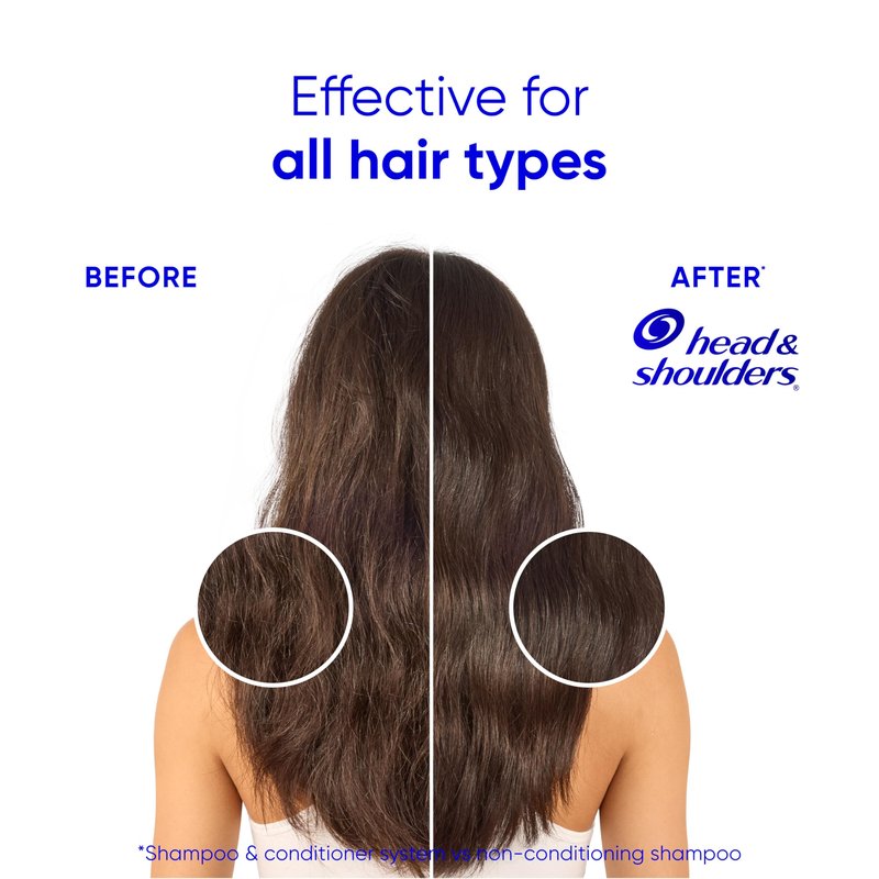 Head & Shoulders Anti-Dandruff Shampoo and Conditioner with 1% Pyrithione Zinc, Smooth & Silky 2 in 1, 24-Hour Frizz Control, Soothes Dry & Itchy Scalp, Leaves Hair Healthy, Shiny & Smooth, 28.2 Fl Oz