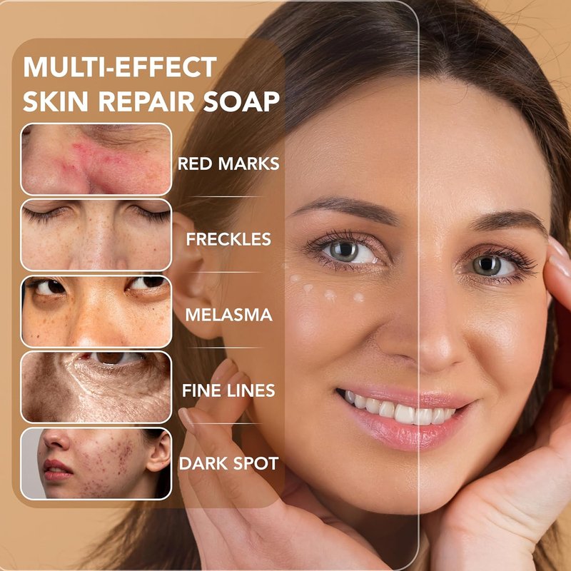 Dark Spot Remover Soap Bars - Vitamin C, Retinol & Collagen Infused | Turmeric & Hyaluronic Acid Benefits